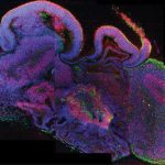 brain organoids