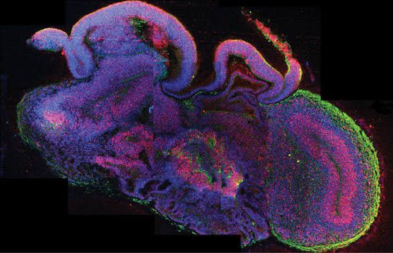 brain organoids